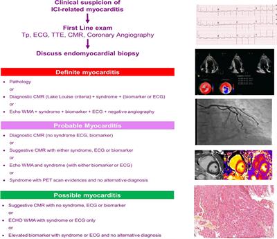 Role of Cardiac Imaging in the Diagnosis of Immune Checkpoints Inhibitors Related Myocarditis